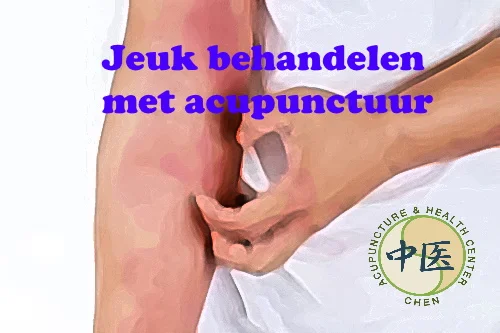 Acupunctuur bij jeukende huid