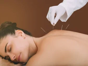 Stressklachten acupunctuur stress