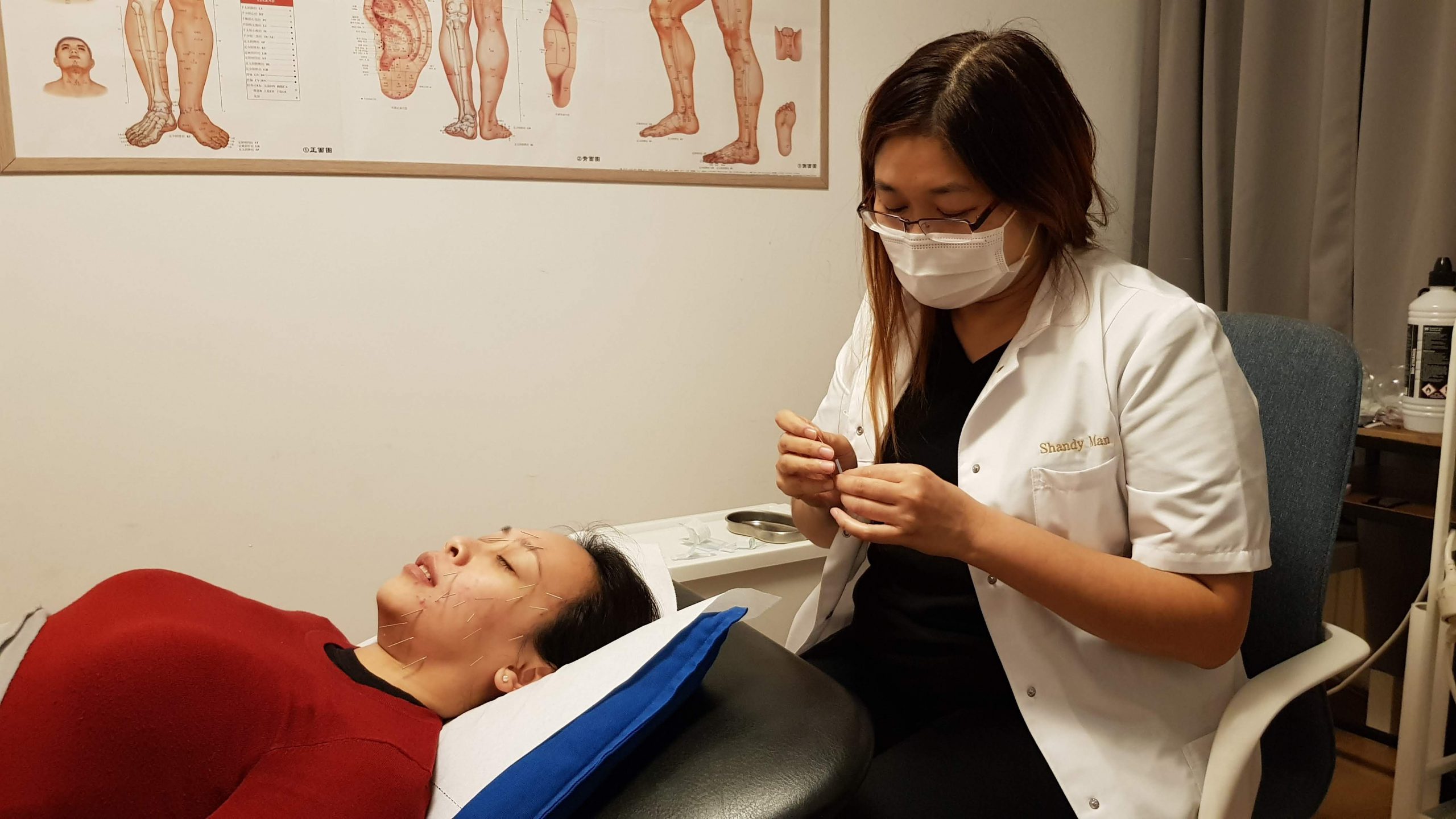 acupunctuur rimpels