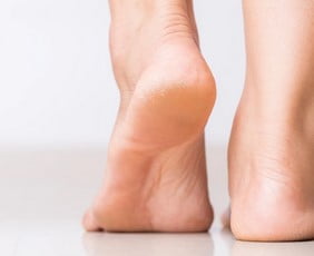 Hielspoor acupunctuur