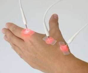 Laseracupunctuur rotterdam