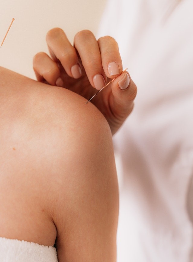 Acupunctuur bij schouderpijn AHC Chen