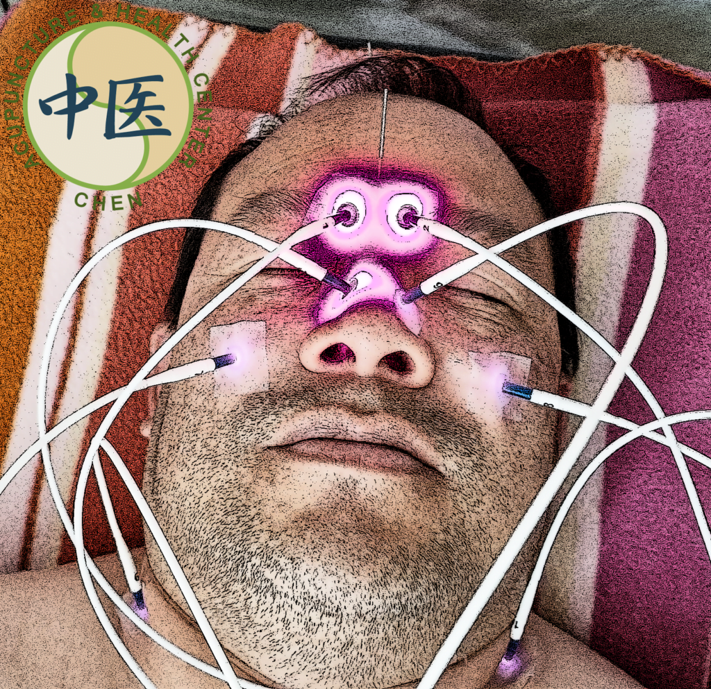 Sinusitis behandelen met laseracupunctuur Rotterdam
