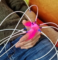 Laseracupunctuur Rotterdam Chen