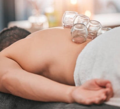 Cupping bij sporters